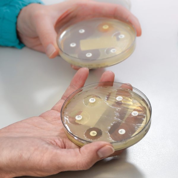 تست حساسیت میکروبی | آنتی بیوگرام | دیسک دفیوژن | کربی بائر