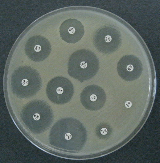 تست حساسیت میکروبی | آنتی بیوگرام | دیسک دفیوژن | کربی بائر
