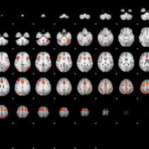 آنالیز و پردازش تصاویر عملکردی (fMRI)