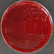 پروپیونی باکتریوم اکنس Propionibacterium acnes