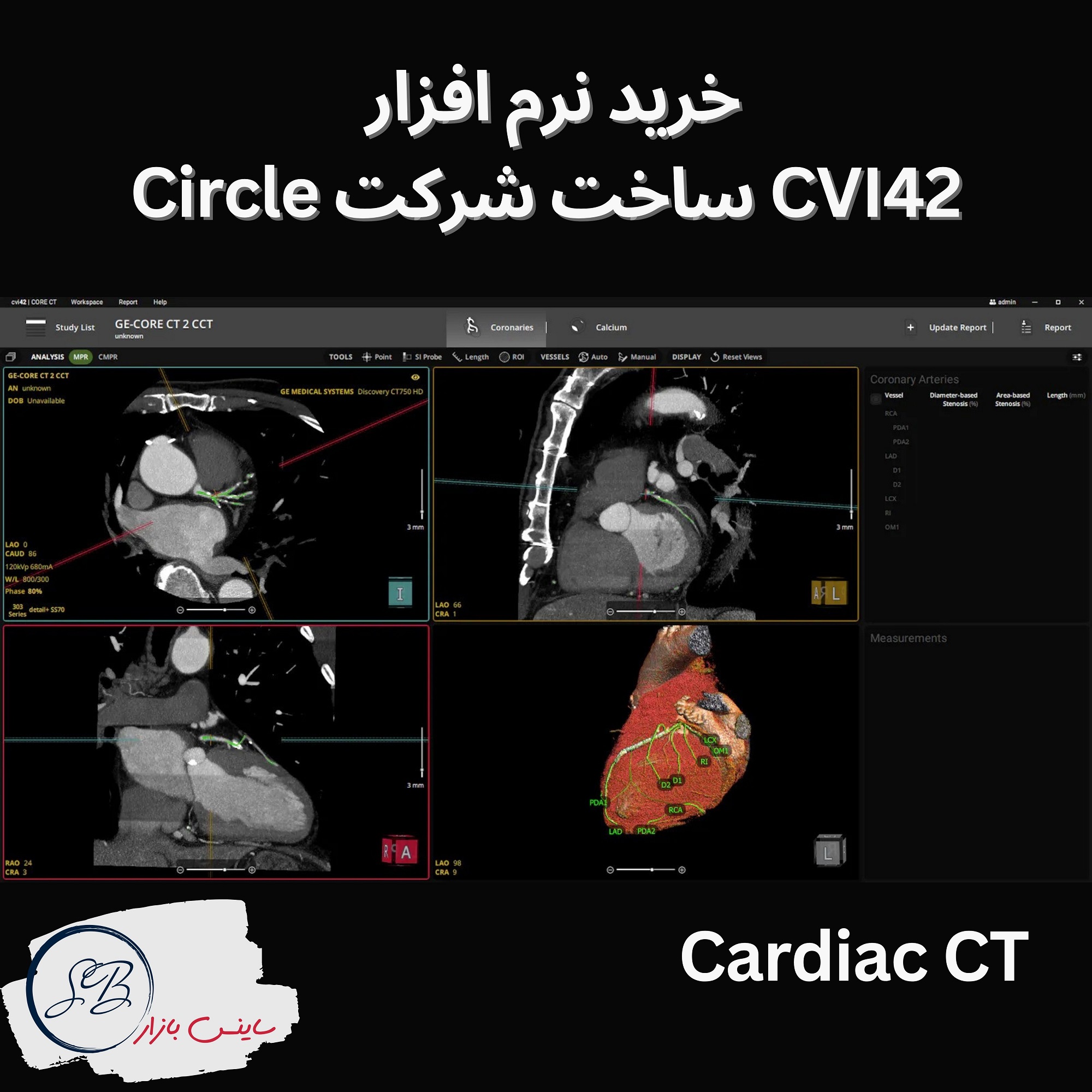 نرم‌افزار CVI42 ساخت شرکت Circle