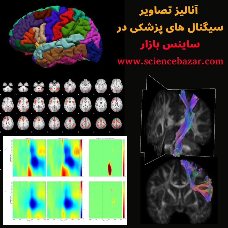 آنالیز تصاویر پزشکی