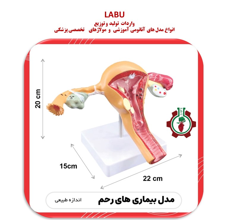 مولاژ بیماریهای رحم