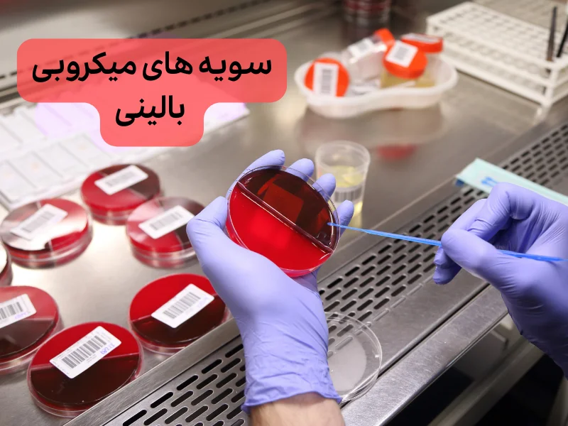 فروش سویه های بالینی