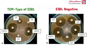 تشخیص مقاومت esbl