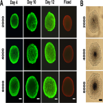 Spheroid Assay