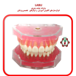 مولاژ دندان با لثه نرم و با قابلیت جدا شدن دندان ها