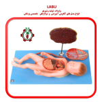مولاژ جنین با نمایش جفت و ویسکوز