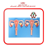 مدل رحم و تخمدان با نمایش بیماری