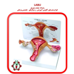 مولاژ رحم و تخمدان