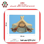 مدل نخاع درون مهره