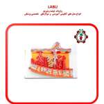 مولاژ جفت پاتولوژیک ( ۱۴*۱۸)