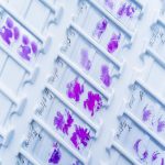 Bacterial slide preparation