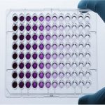 تست تکثیر و بقا سلولی MTT assay