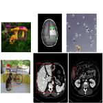 شناسایی اجسام در تصویر پزشکی Object Detection -