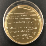 لاکتوباسیلوس پلانتاروم Lactobacillus plantarum