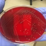 لیستریا مونوسیتوژنز Listeria monocytogenes