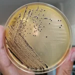 Baird-Parker Agar