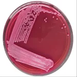 MacConkey Agar