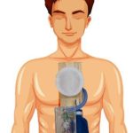 مولاژ آموزش پایه احیا قلبی ریوی